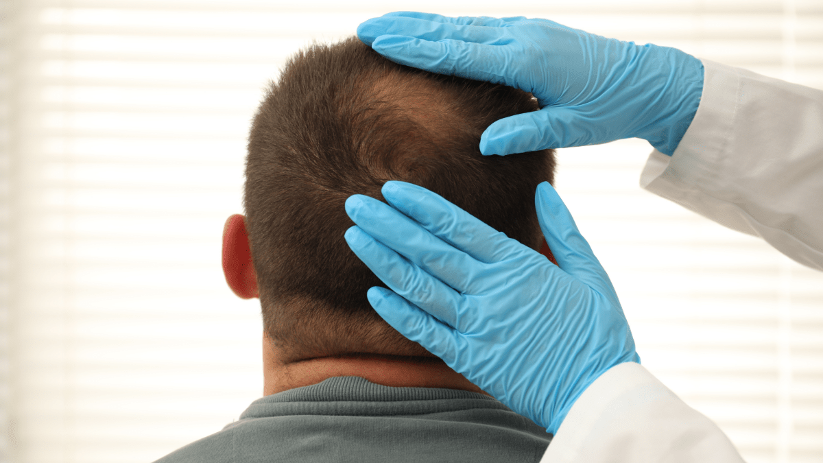 Alimentazione per capelli più forti: i nutrienti chiave e gli errori comuni - Desiros